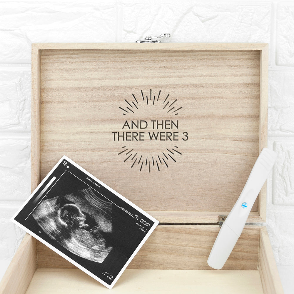 Personalised Surprise Announcement Box - treat-republic